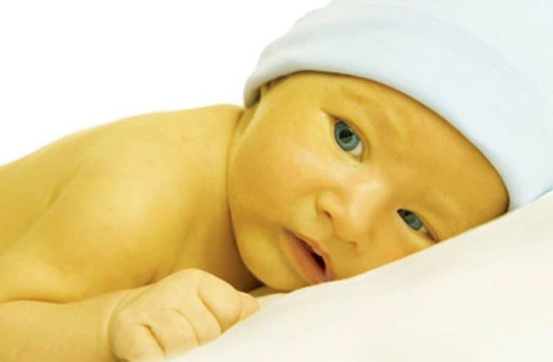 Mẹo dân gian chữa vàng da ở trẻ sơ sinh đơn giản các mẹ nên biết.